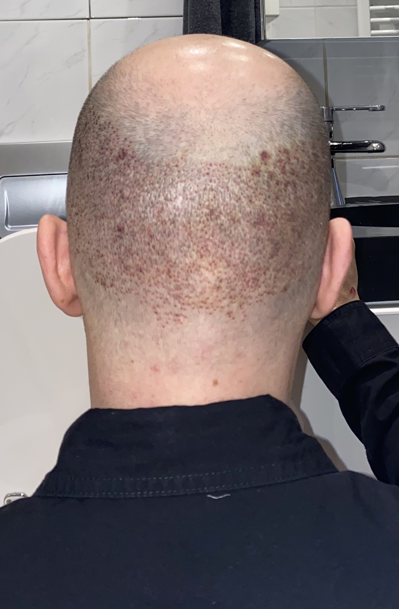 /foren/transplant/index.php/fa/45852/0/