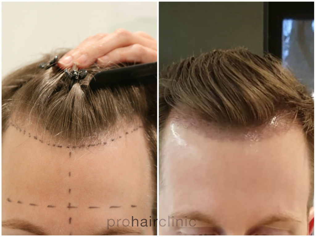 /foren/transplant/index.php/fa/45879/0/