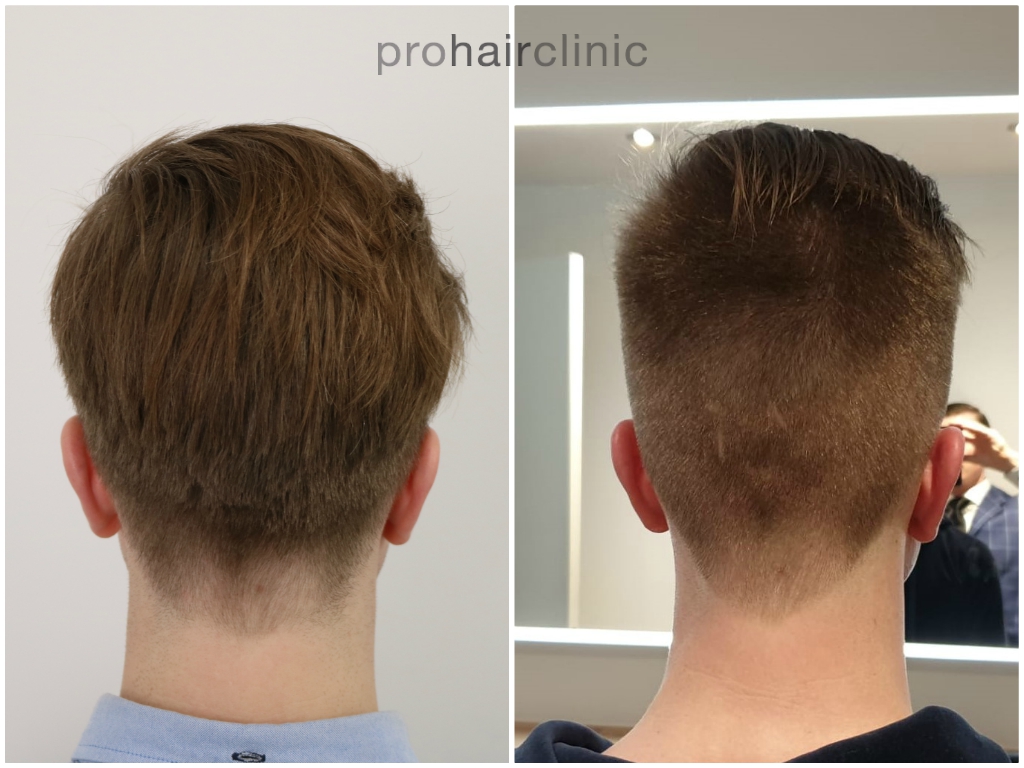 /foren/transplant/index.php/fa/45880/0/