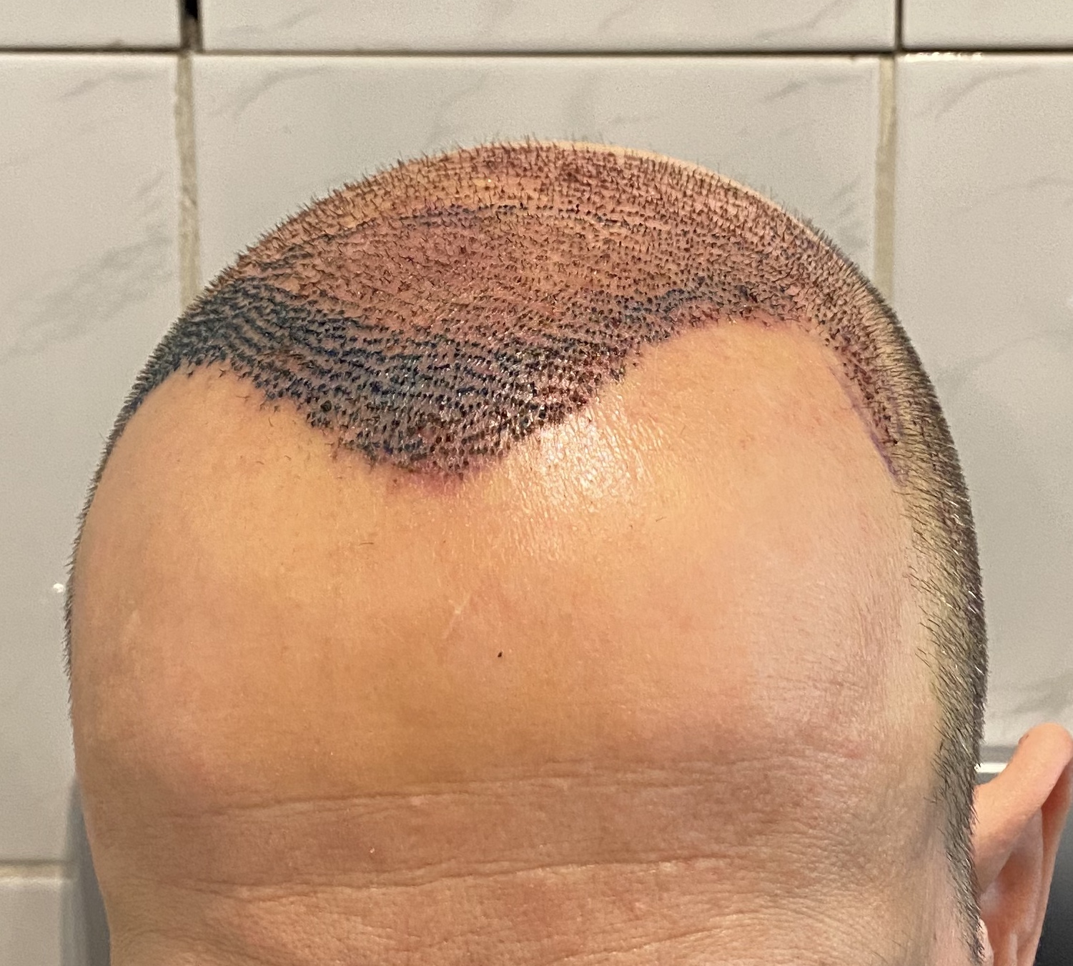 /foren/transplant/index.php/fa/45882/0/