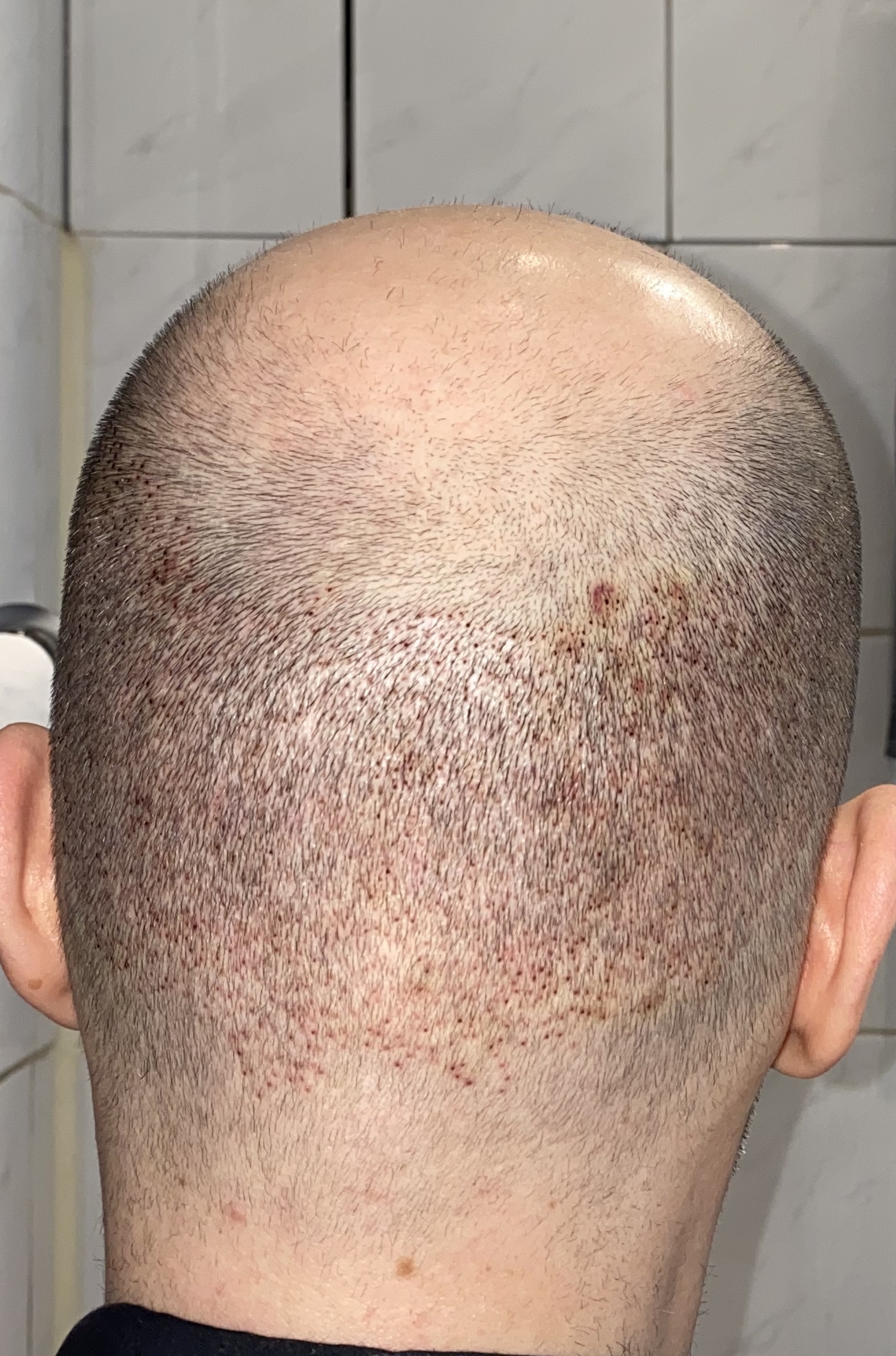 /foren/transplant/index.php/fa/45883/0/