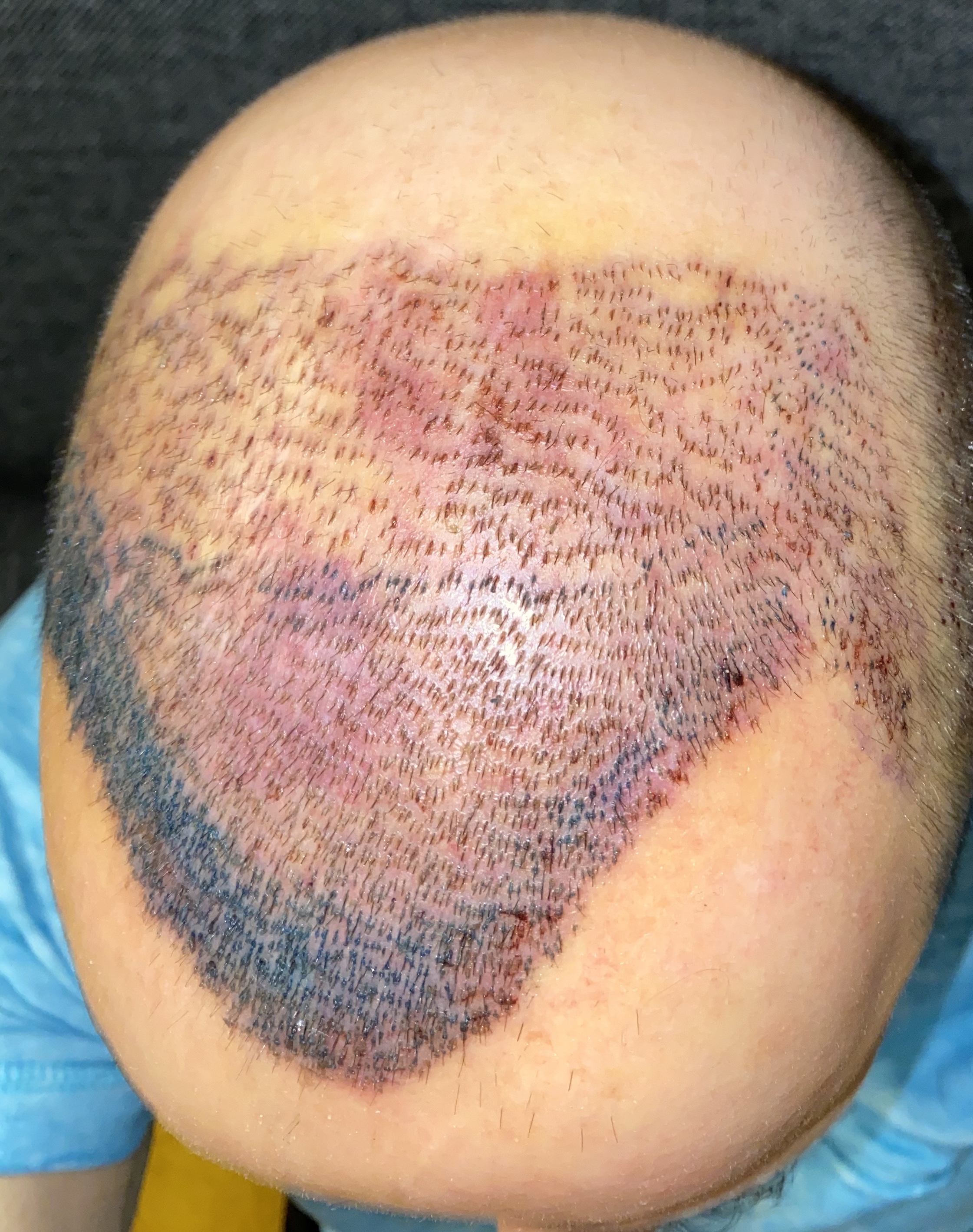 /foren/transplant/index.php/fa/45939/0/