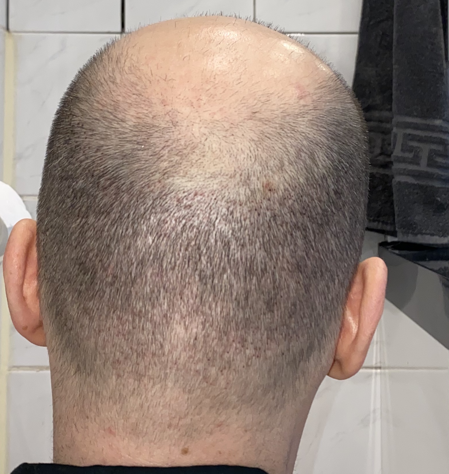 /foren/transplant/index.php/fa/45974/0/