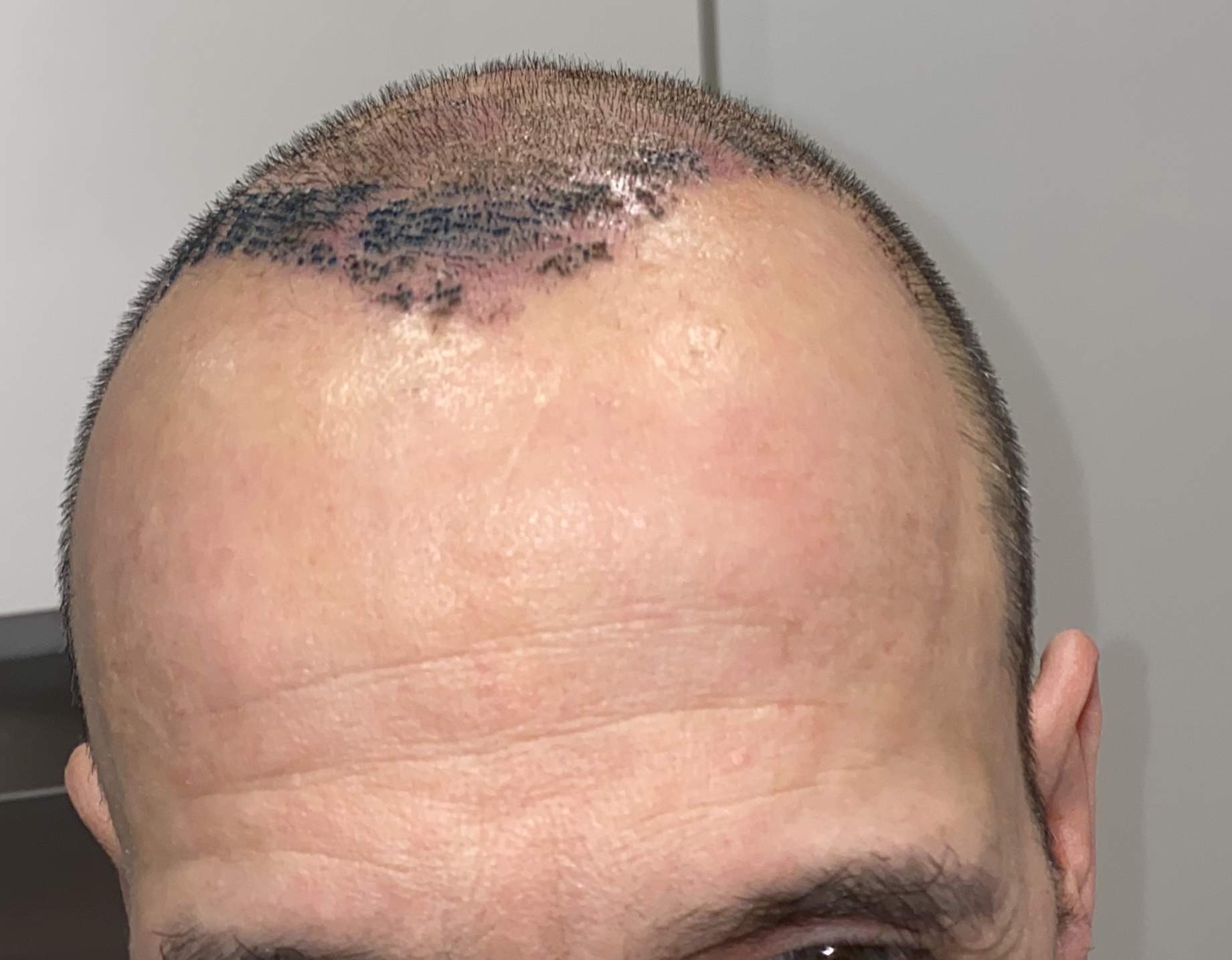 /foren/transplant/index.php/fa/45975/0/