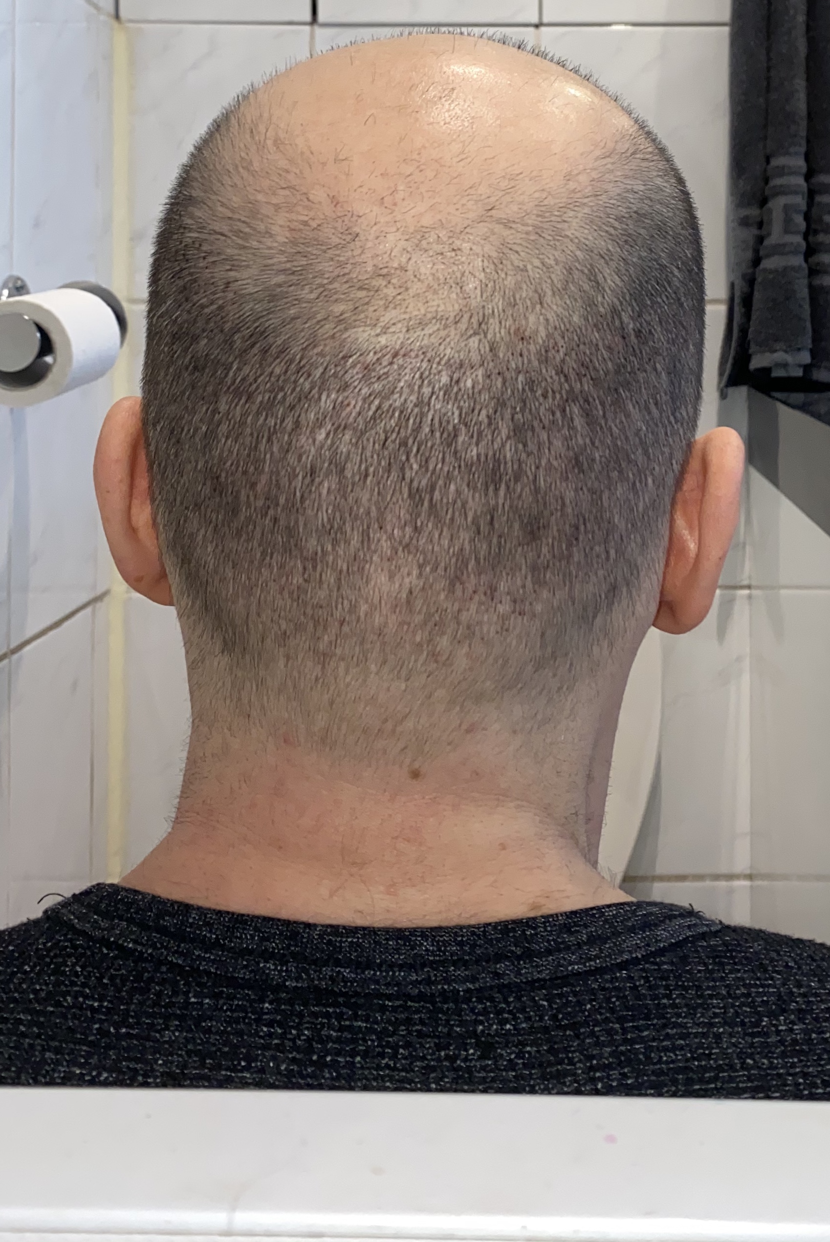 /foren/transplant/index.php/fa/45976/0/