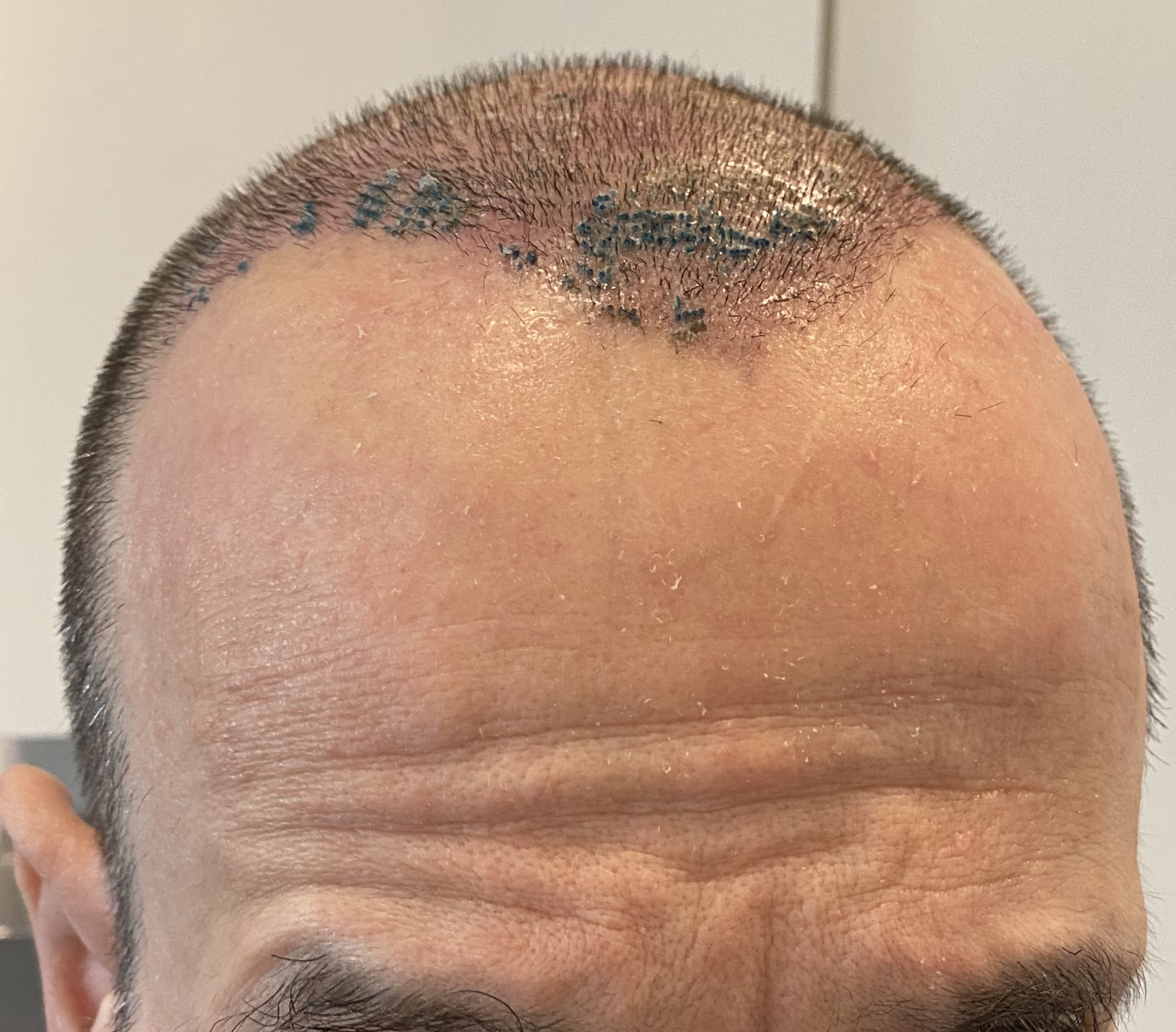 /foren/transplant/index.php/fa/45977/0/