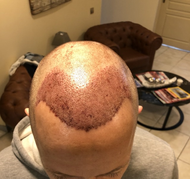 /foren/transplant/index.php/fa/46030/0/