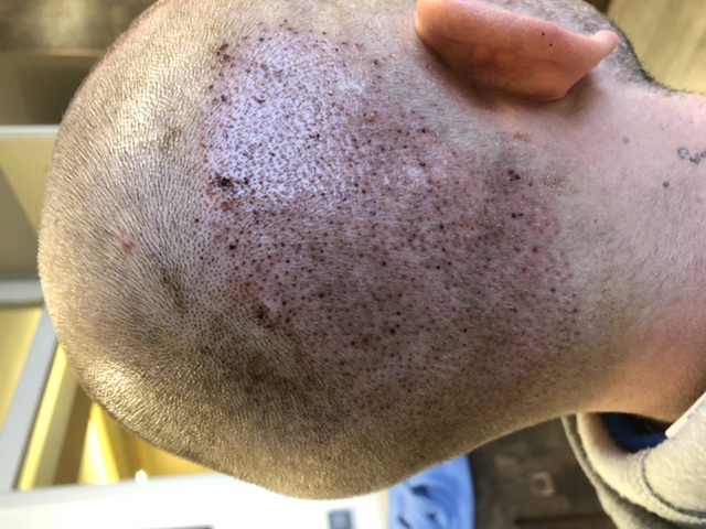 /foren/transplant/index.php/fa/46031/0/