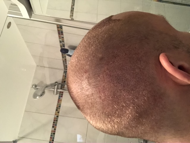 /foren/transplant/index.php/fa/46032/0/