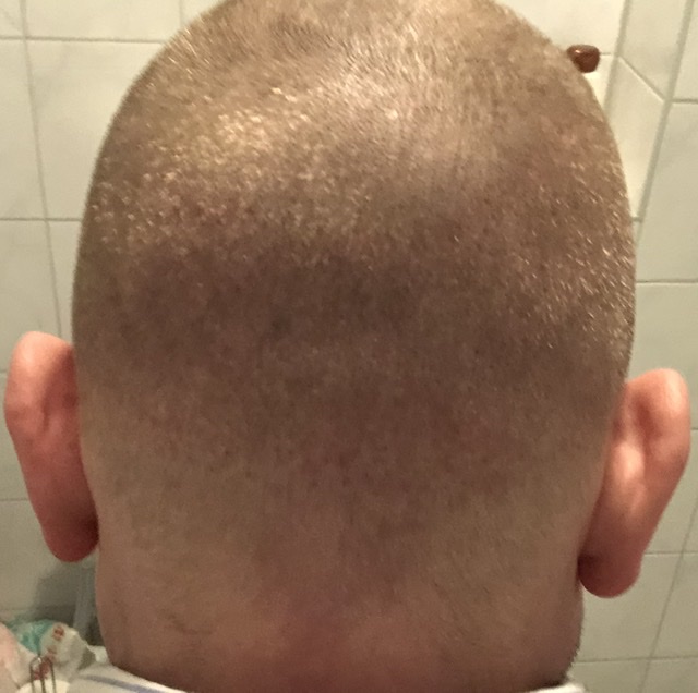 /foren/transplant/index.php/fa/46033/0/