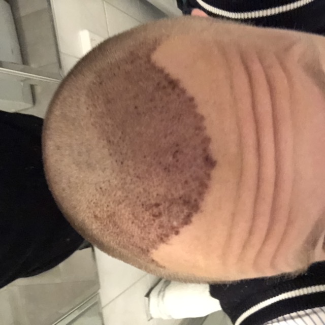 /foren/transplant/index.php/fa/46034/0/