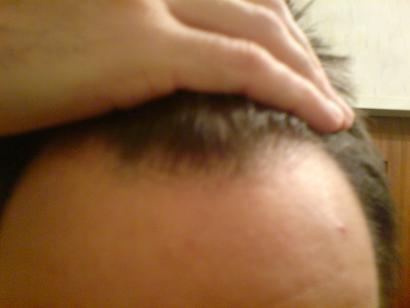 index.php/fa/4606/0/