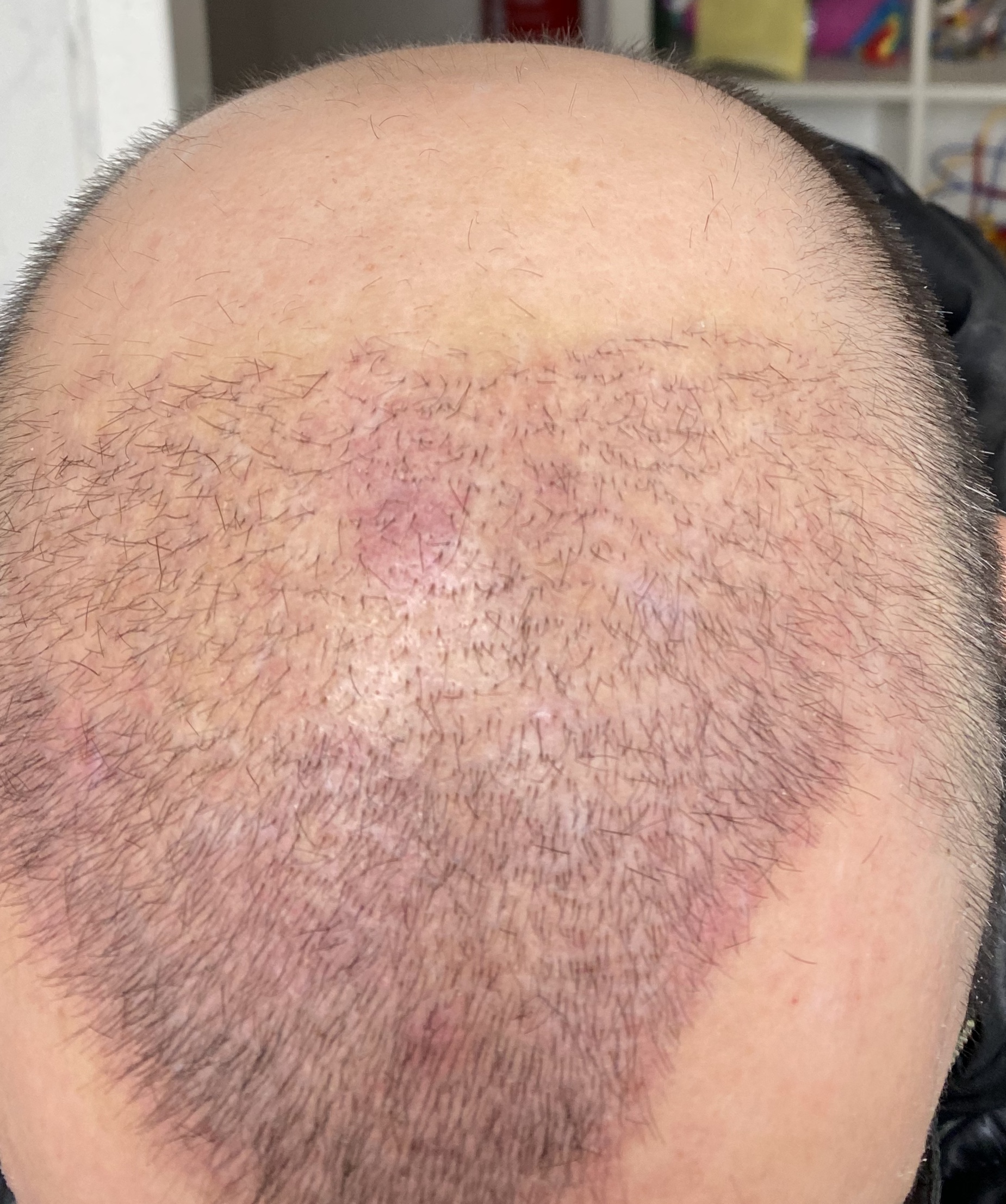 /foren/transplant/index.php/fa/46061/0/