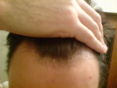 index.php/fa/4607/0/