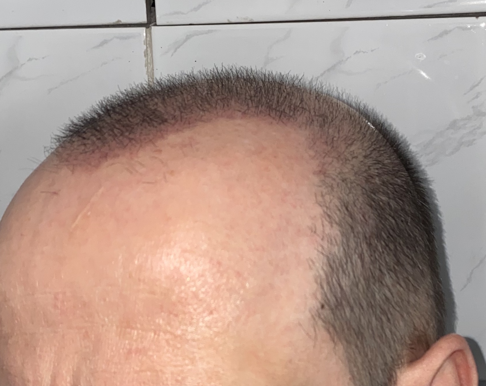 /foren/transplant/index.php/fa/46156/0/