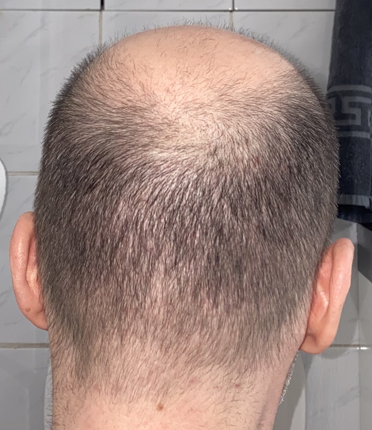 /foren/transplant/index.php/fa/46157/0/