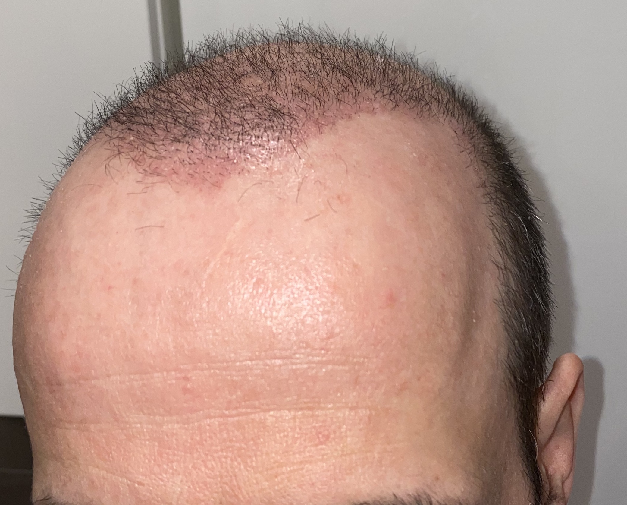 /foren/transplant/index.php/fa/46212/0/