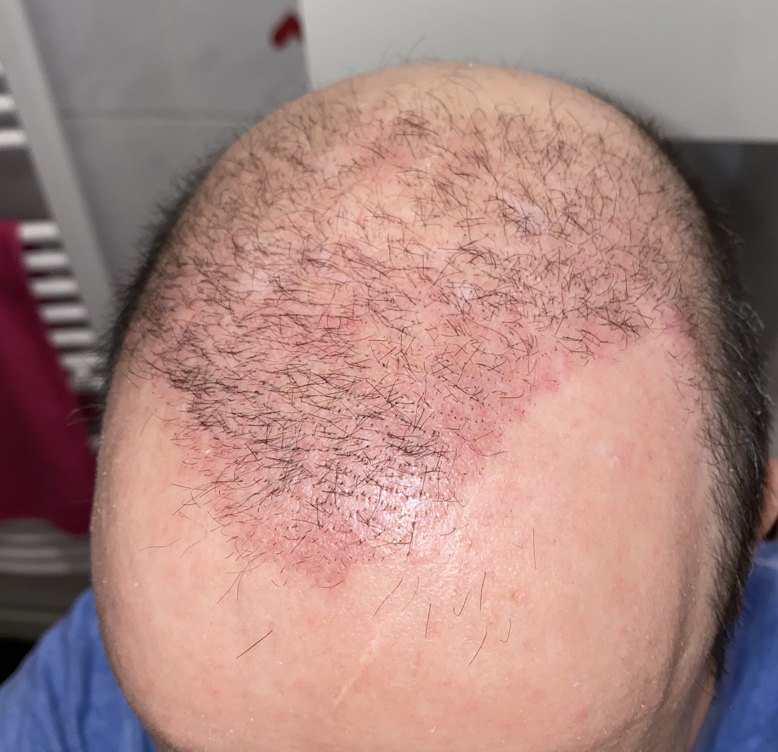 /foren/transplant/index.php/fa/46213/0/