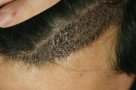 index.php/fa/4629/0/