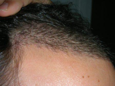 index.php/fa/4630/0/