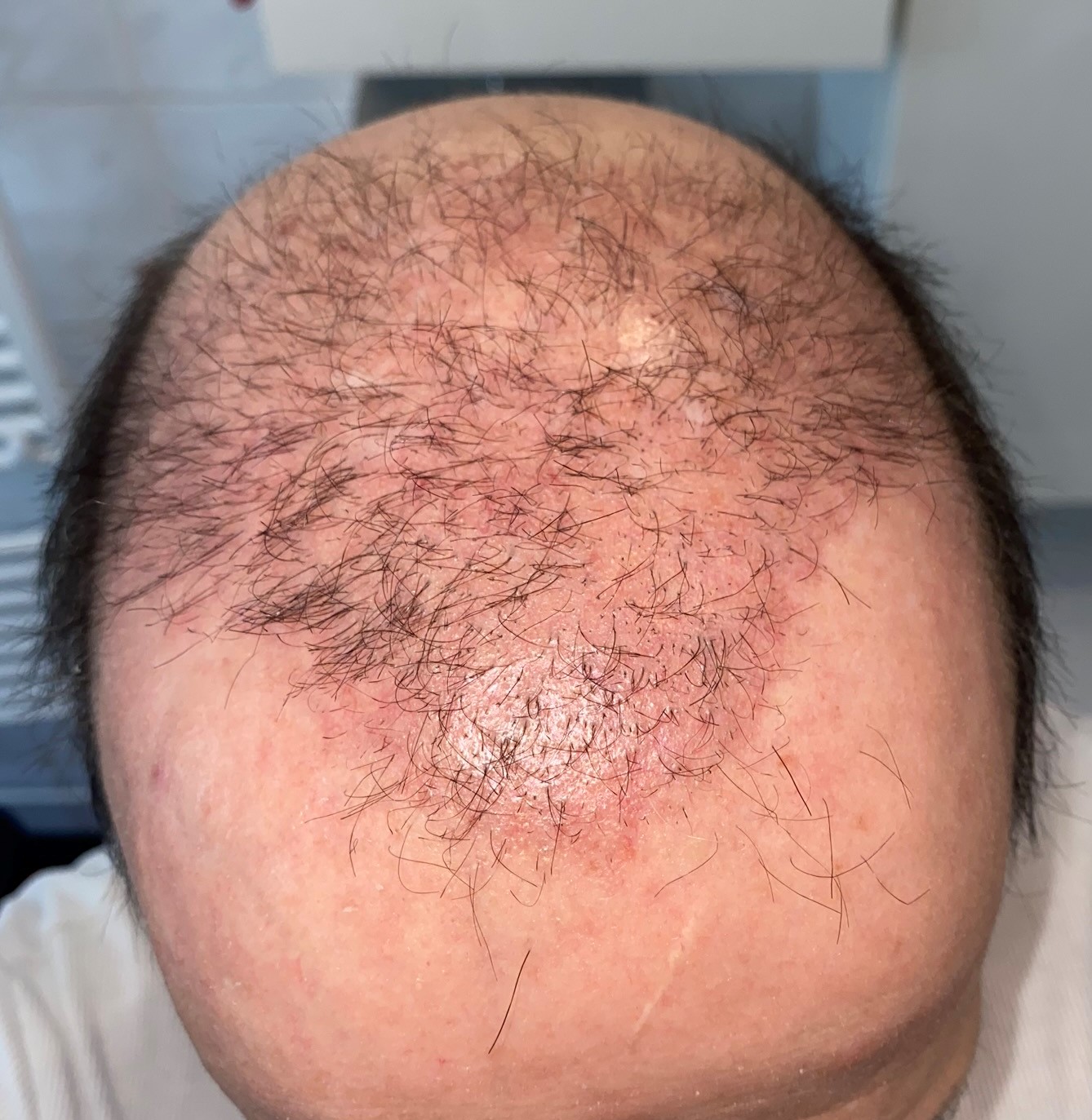 /foren/transplant/index.php/fa/46452/0/