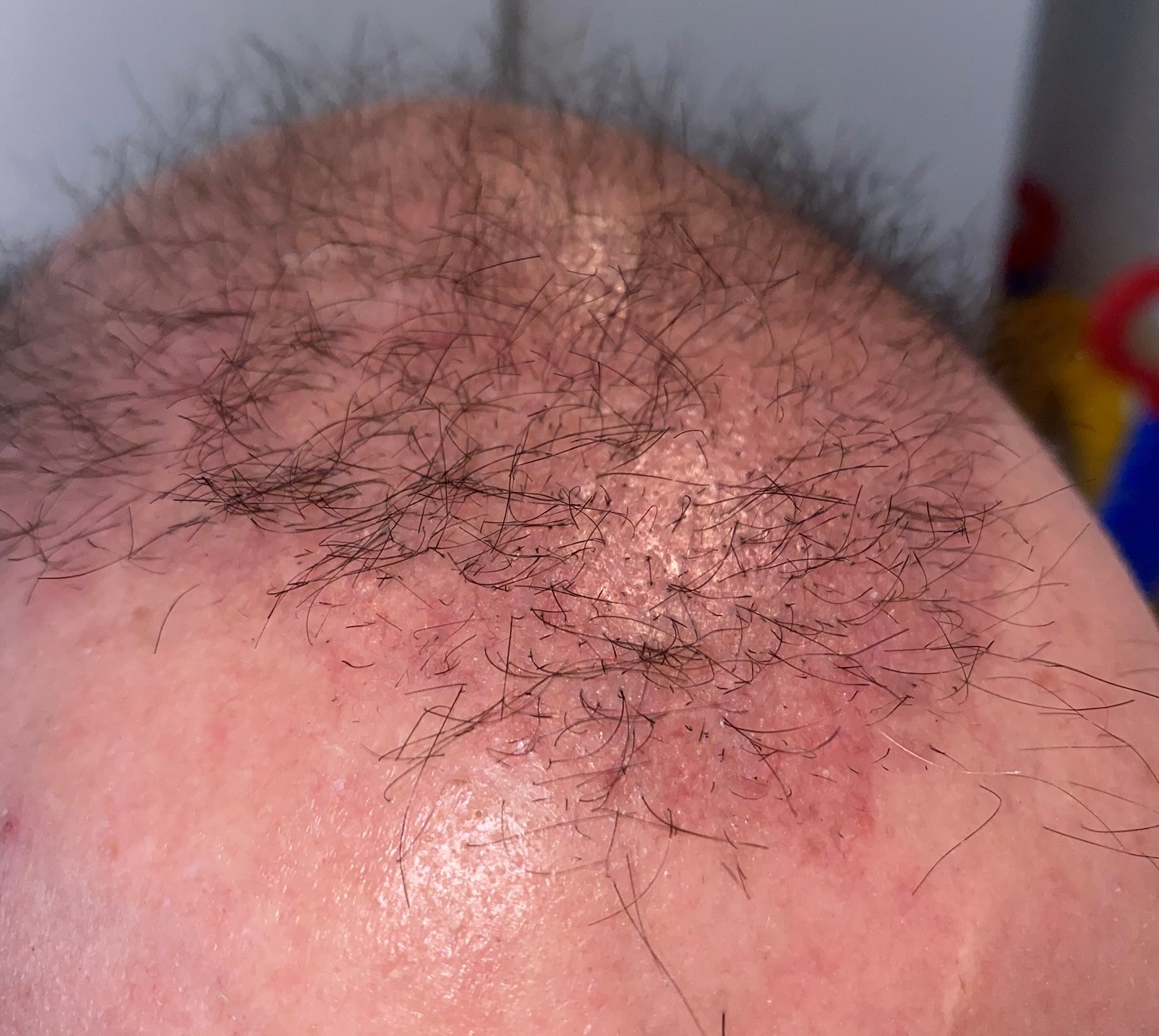 /foren/transplant/index.php/fa/46454/0/