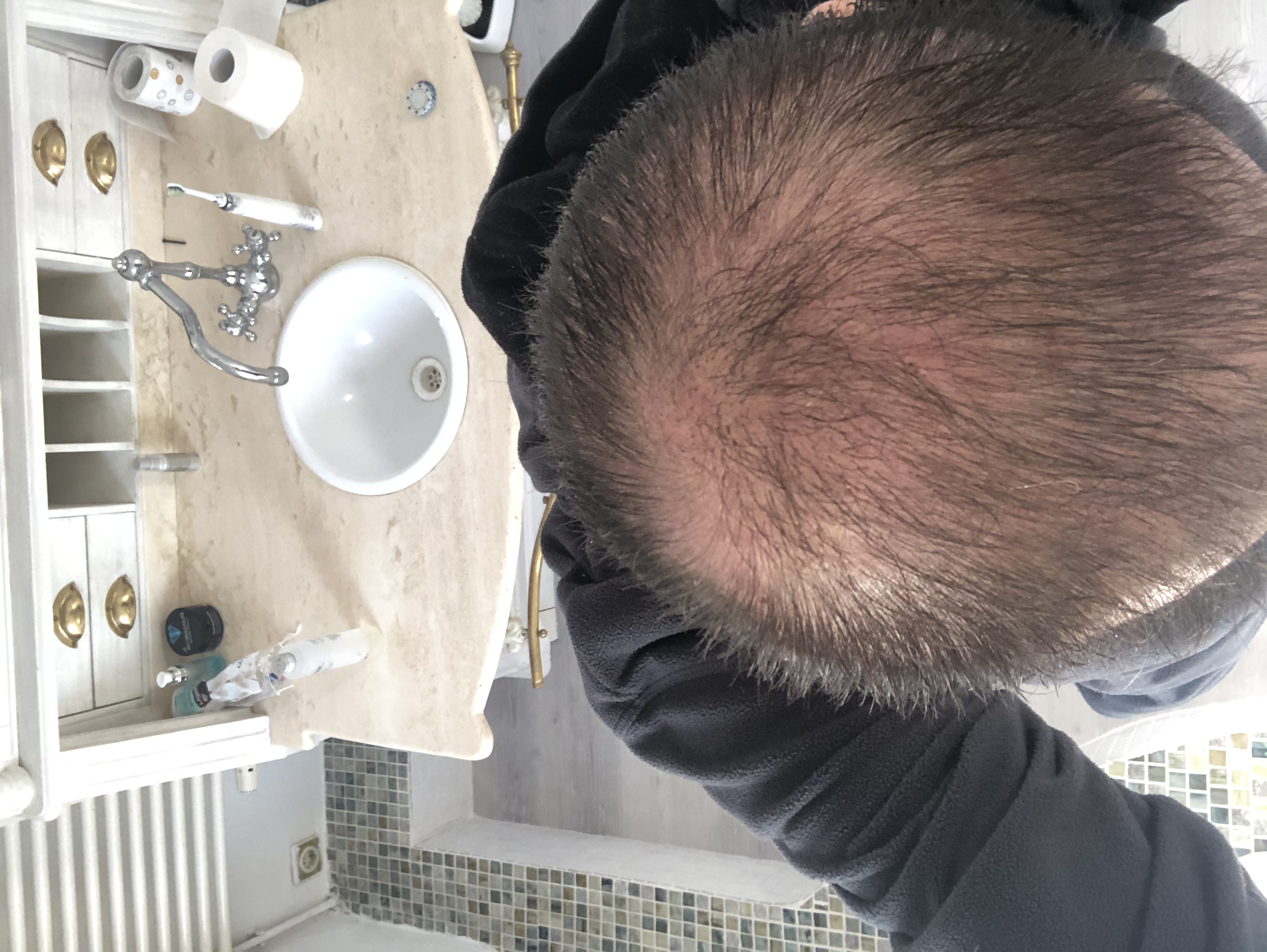 /foren/transplant/index.php/fa/46553/0/