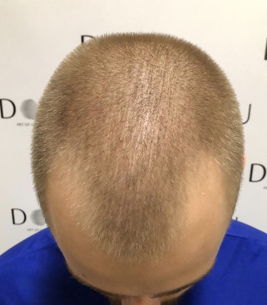 /foren/transplant/index.php/fa/46597/0/