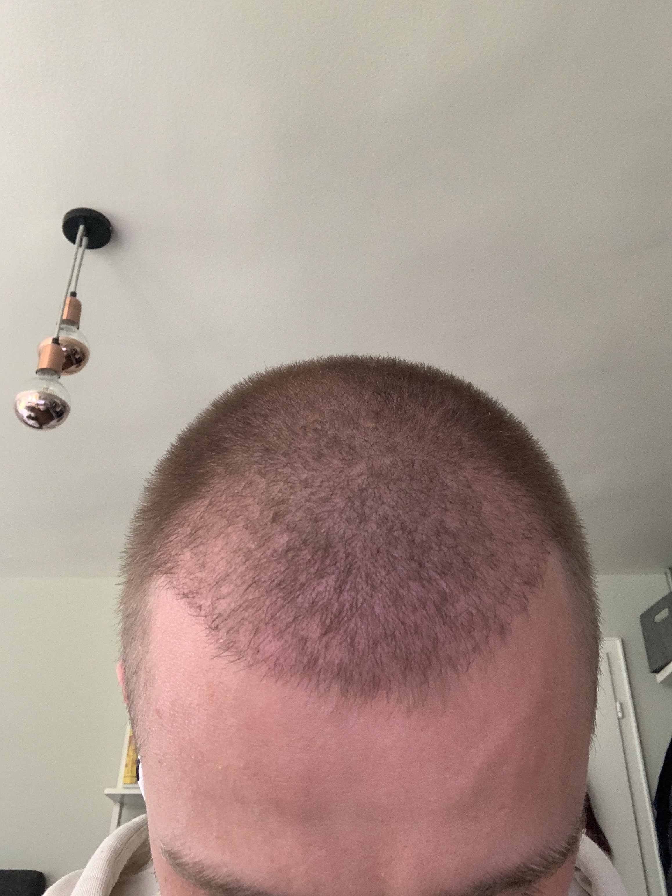 /foren/transplant/index.php/fa/46598/0/