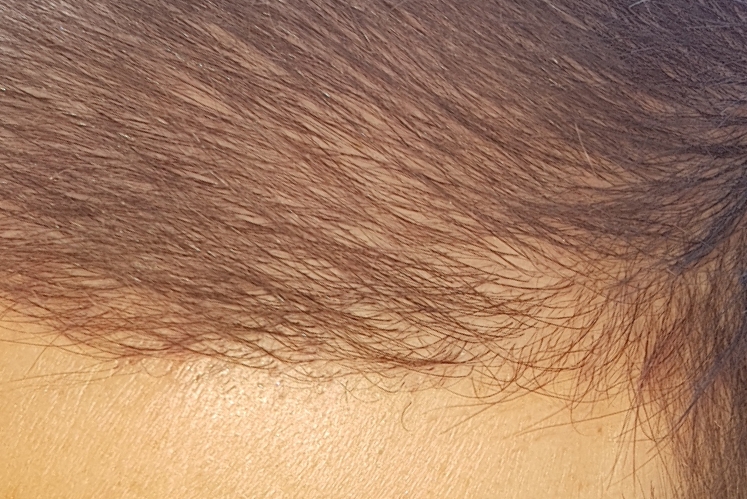 /foren/transplant/index.php/fa/46633/0/