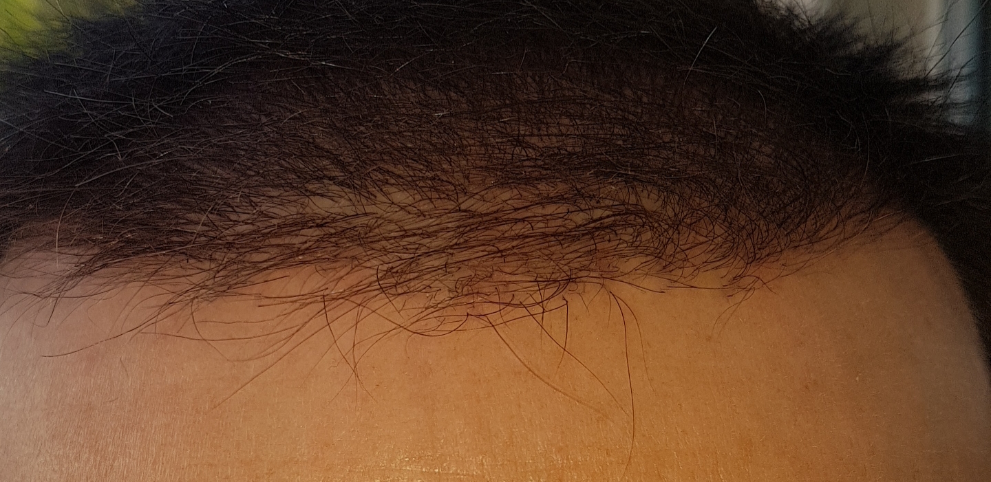 /foren/transplant/index.php/fa/46635/0/