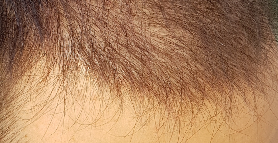 /foren/transplant/index.php/fa/46636/0/