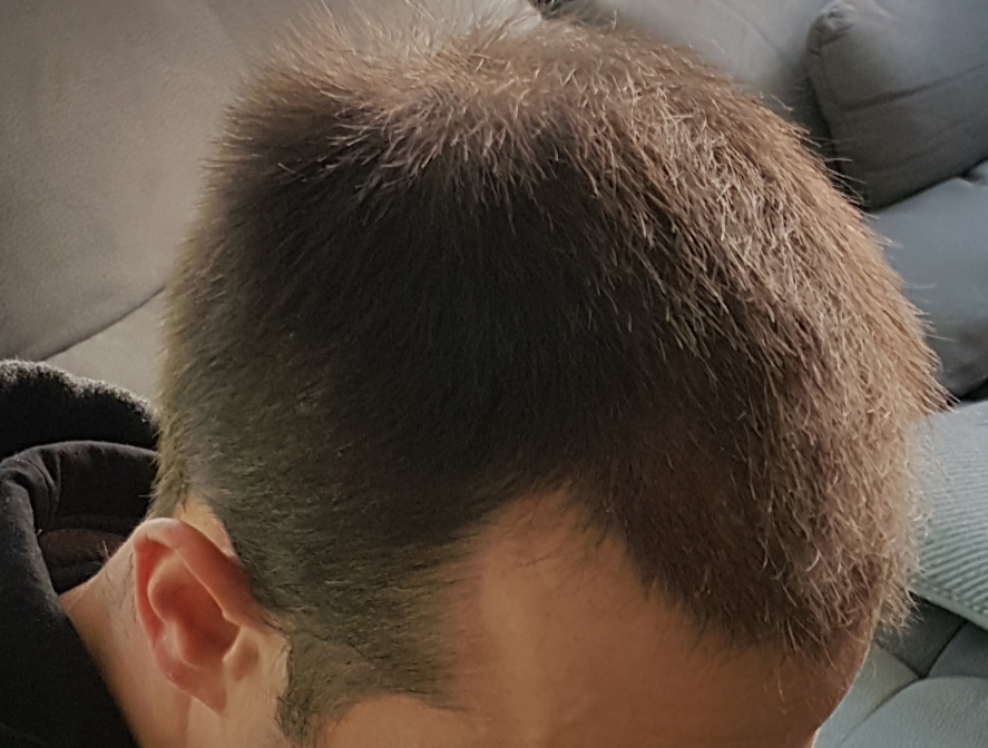 /foren/transplant/index.php/fa/46637/0/