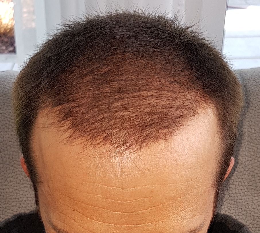 /foren/transplant/index.php/fa/46638/0/