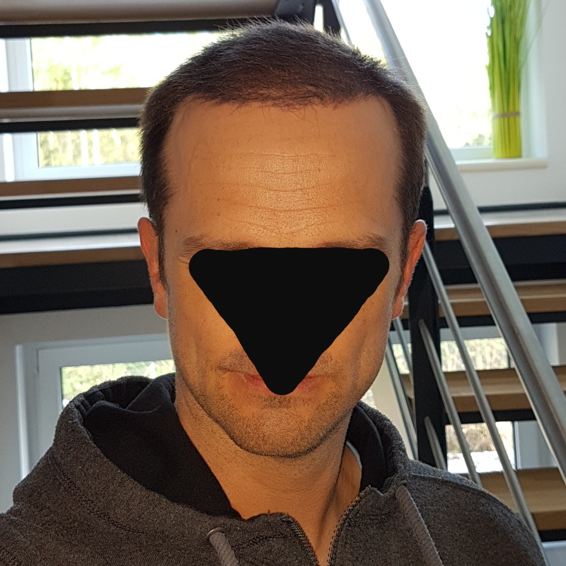 /foren/transplant/index.php/fa/46639/0/