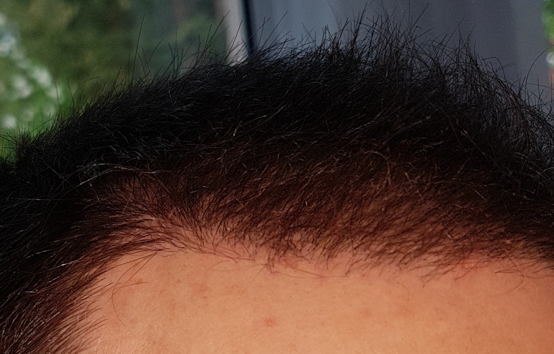 /foren/transplant/index.php/fa/46682/0/