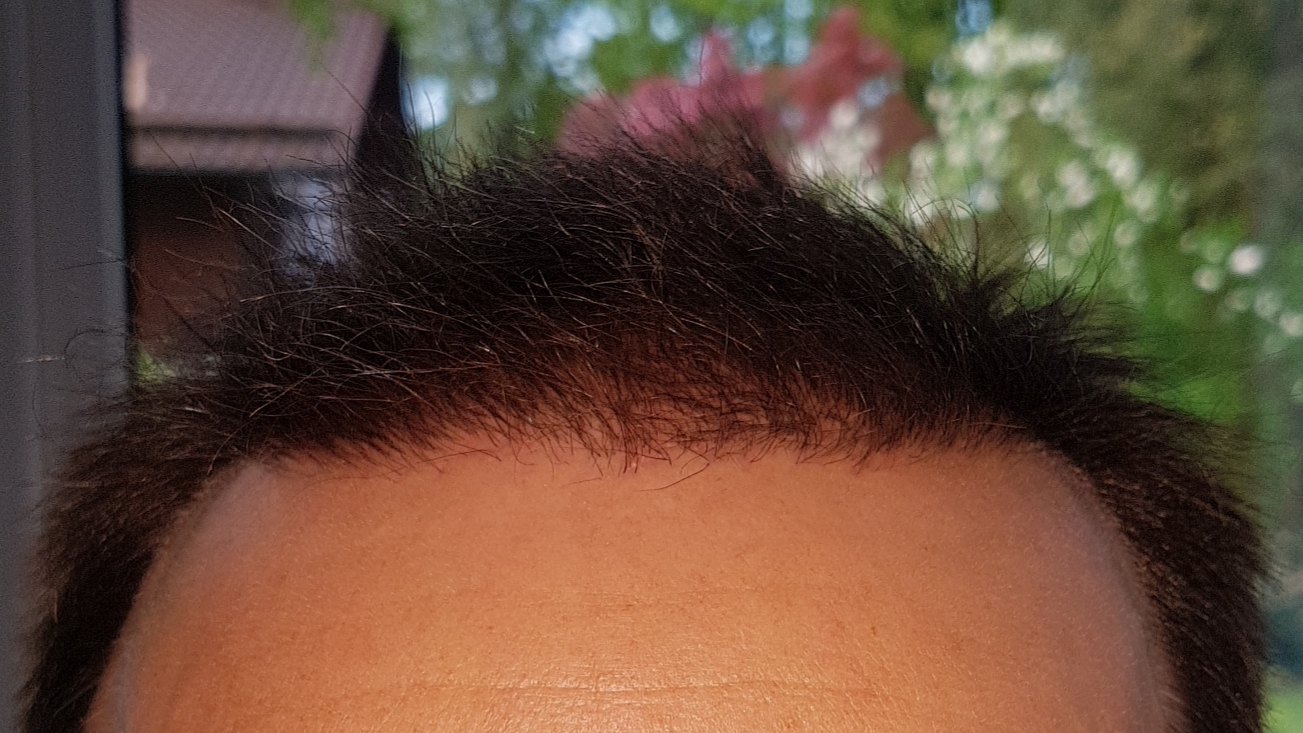 /foren/transplant/index.php/fa/46683/0/