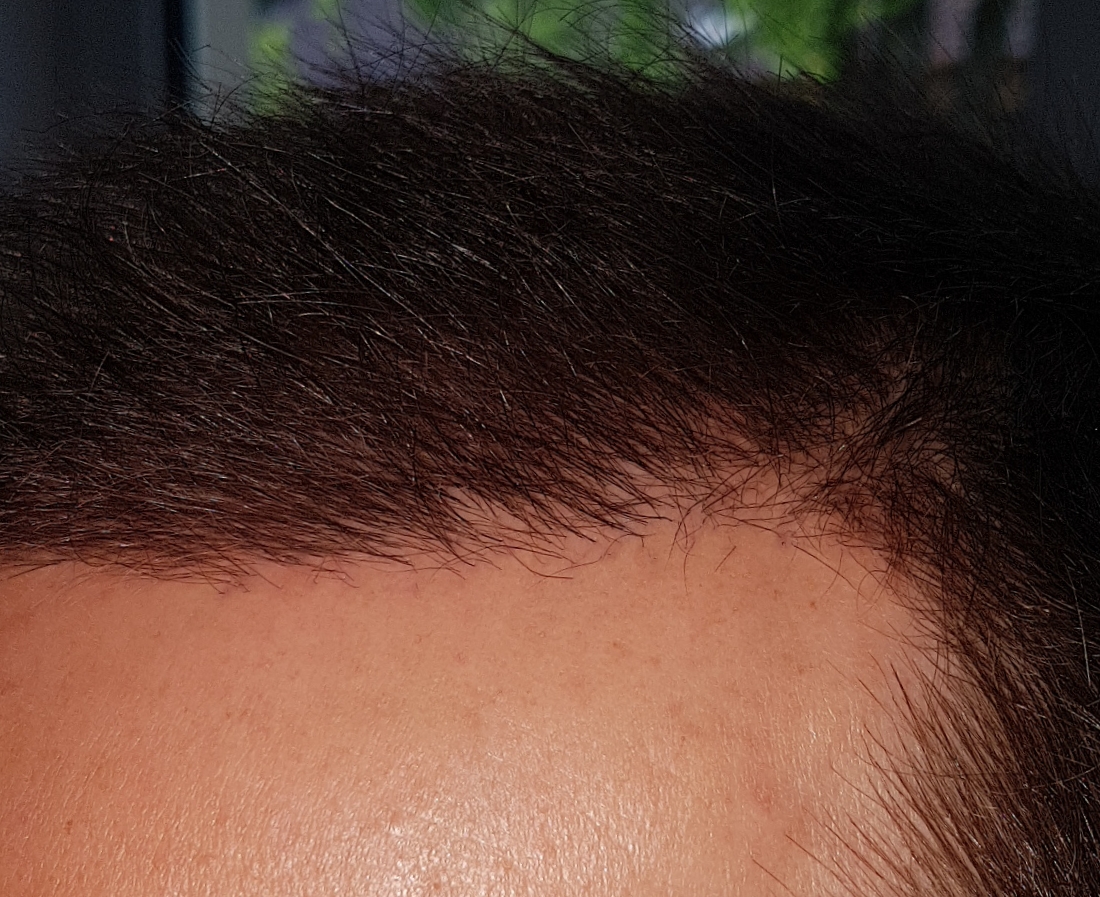 /foren/transplant/index.php/fa/46684/0/