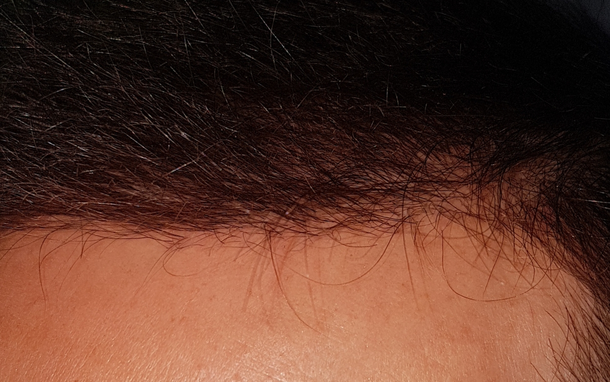 /foren/transplant/index.php/fa/46701/0/