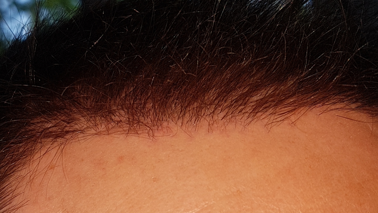 /foren/transplant/index.php/fa/46702/0/