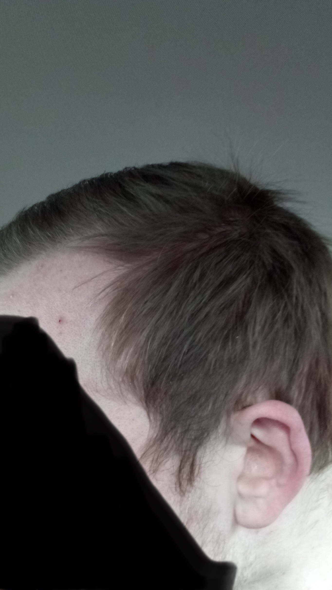 /foren/transplant/index.php/fa/46711/0/