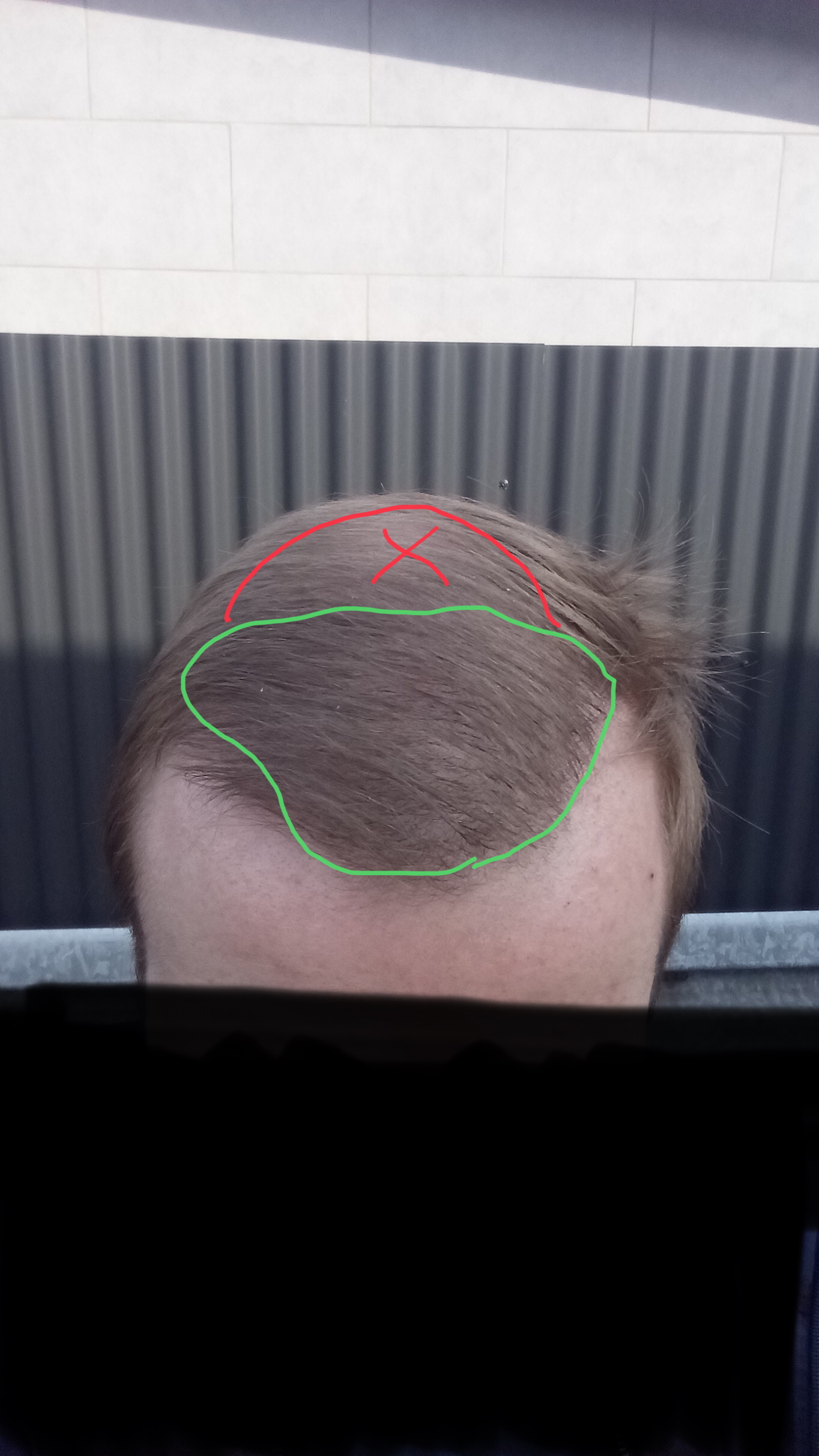 /foren/transplant/index.php/fa/46712/0/