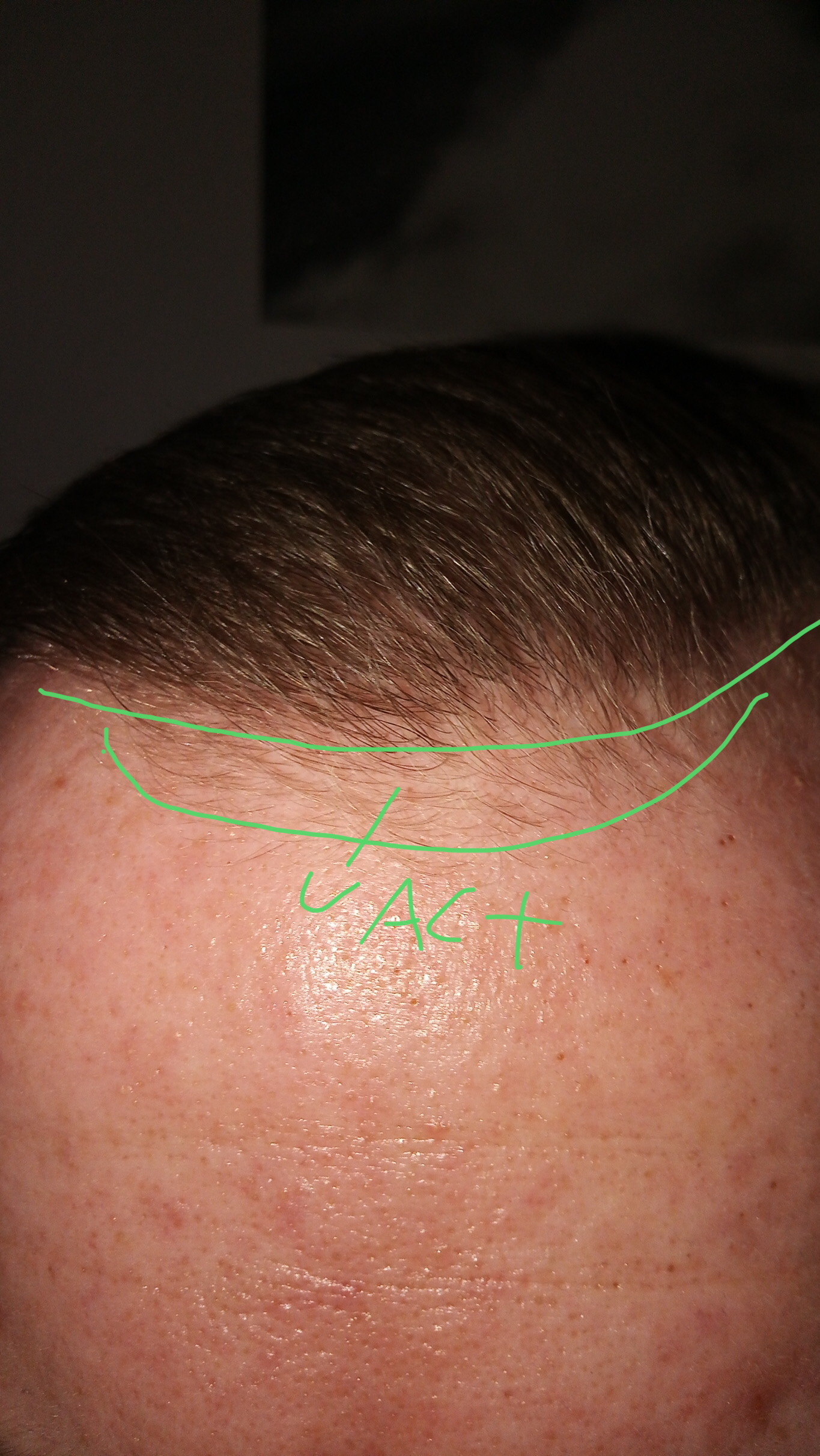 /foren/transplant/index.php/fa/46713/0/