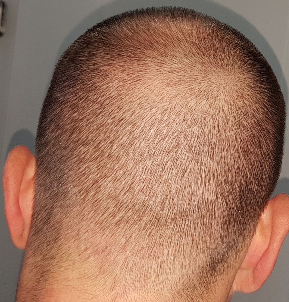 /foren/transplant/index.php/fa/46718/0/