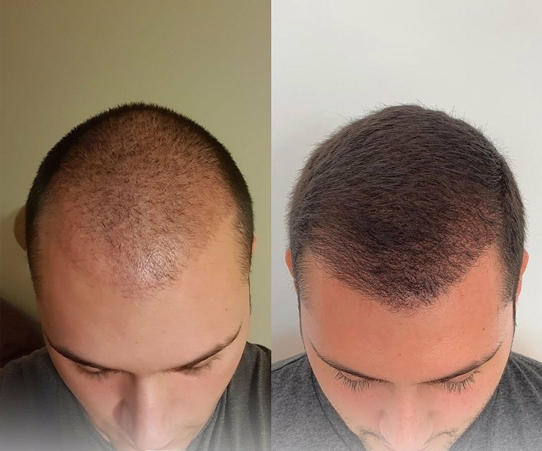 /foren/transplant/index.php/fa/46723/0/