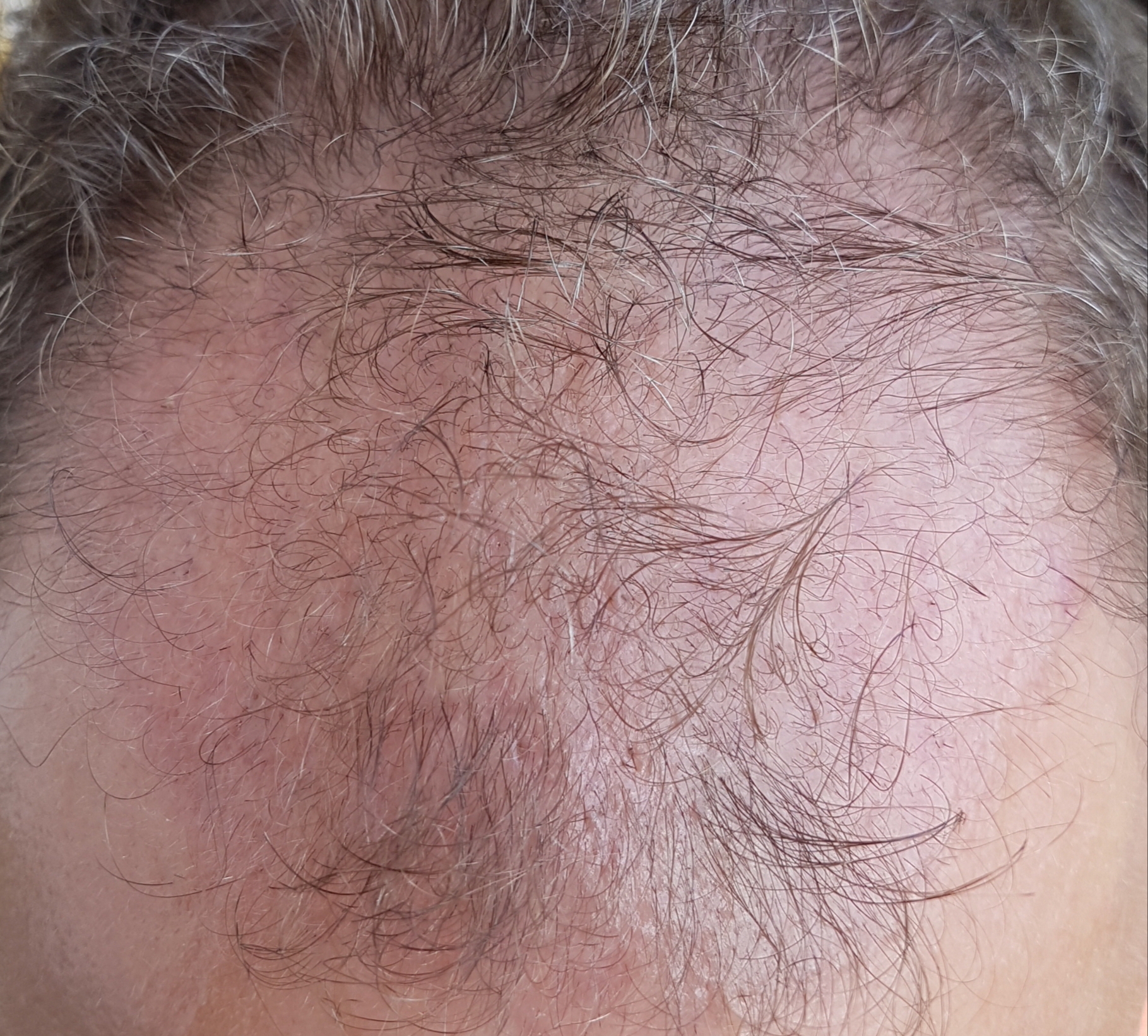 /foren/transplant/index.php/fa/46736/0/