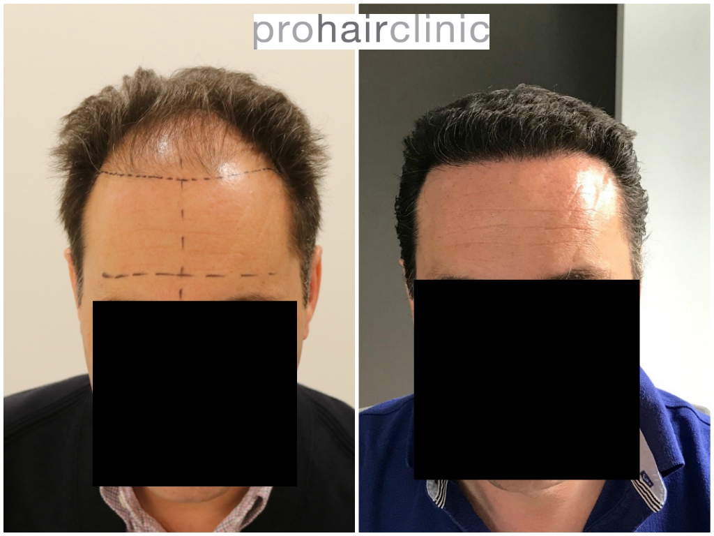 /foren/transplant/index.php/fa/46738/0/