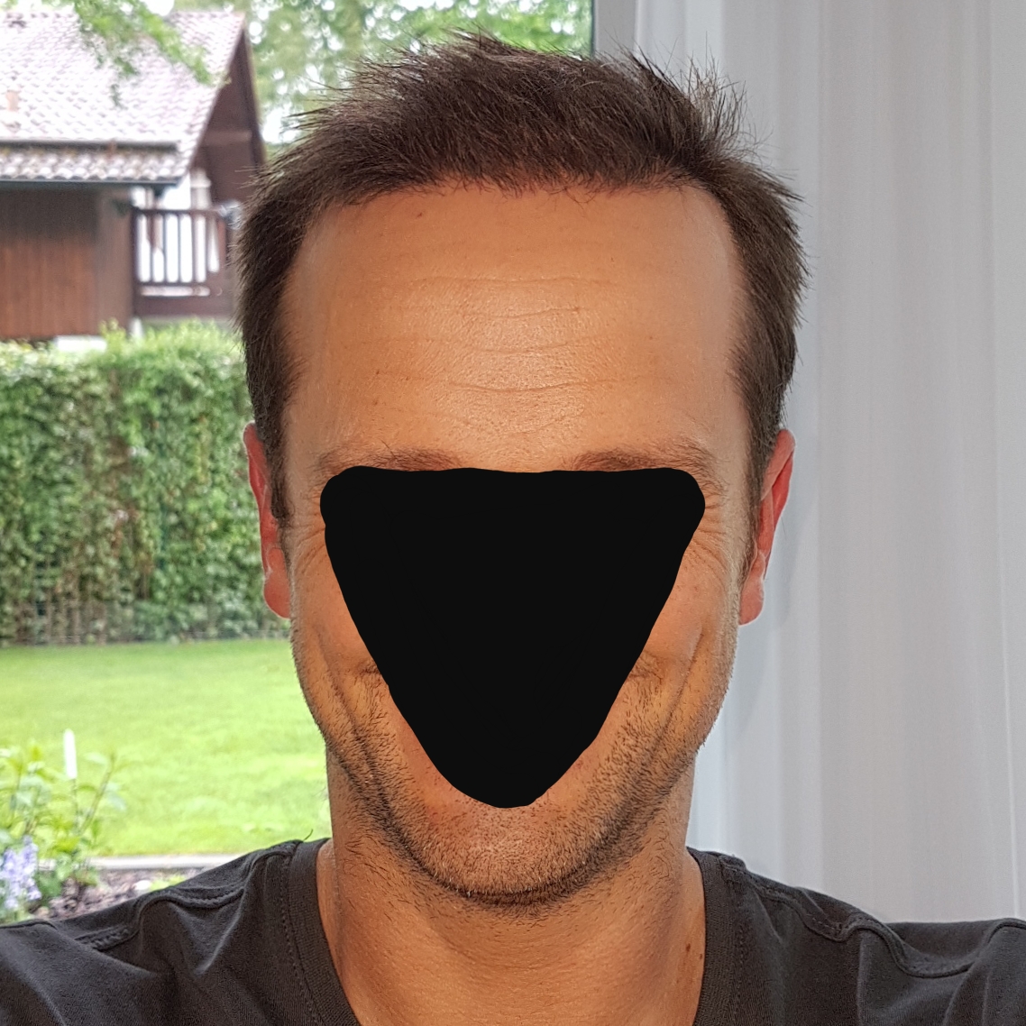 /foren/transplant/index.php/fa/46776/0/