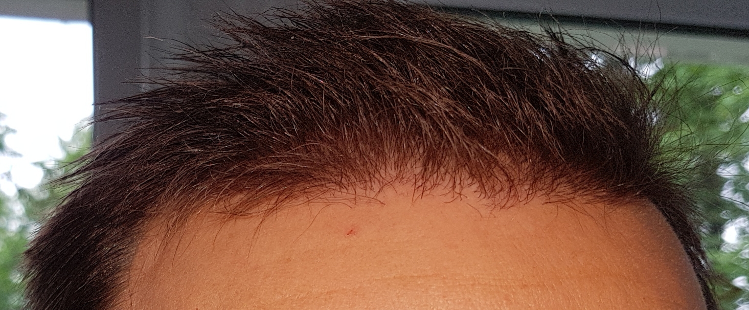 /foren/transplant/index.php/fa/46779/0/