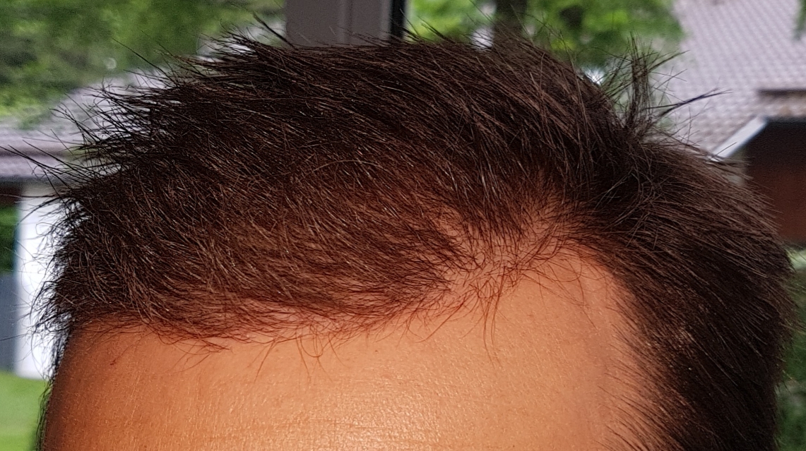 /foren/transplant/index.php/fa/46780/0/